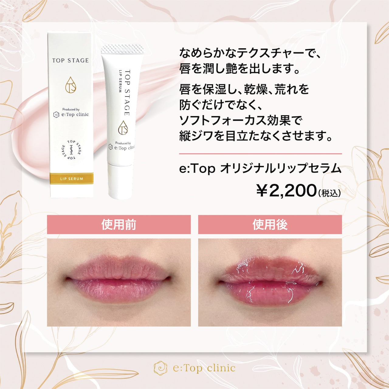 【TOP STAGE】リップセラム